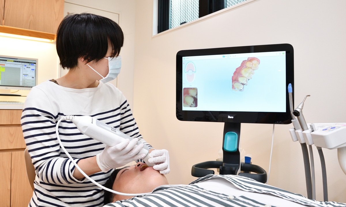 写真:口腔内スキャナーを取得する様子